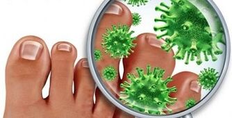 Como tratar uma infecção fúngica nos dedos