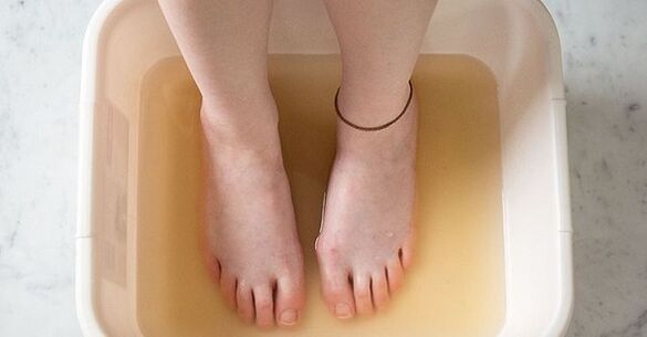 banho de iodo para tratar fungos nas unhas