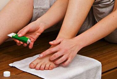 aplicar pomada para tratar fungos nas unhas