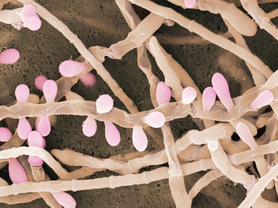 Trichophyton rubrum é um tipo de fungo que afeta a pele dos pés.