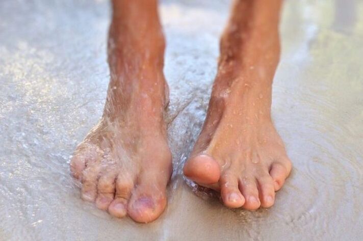 Andar descalço como forma de pegar fungos nas unhas